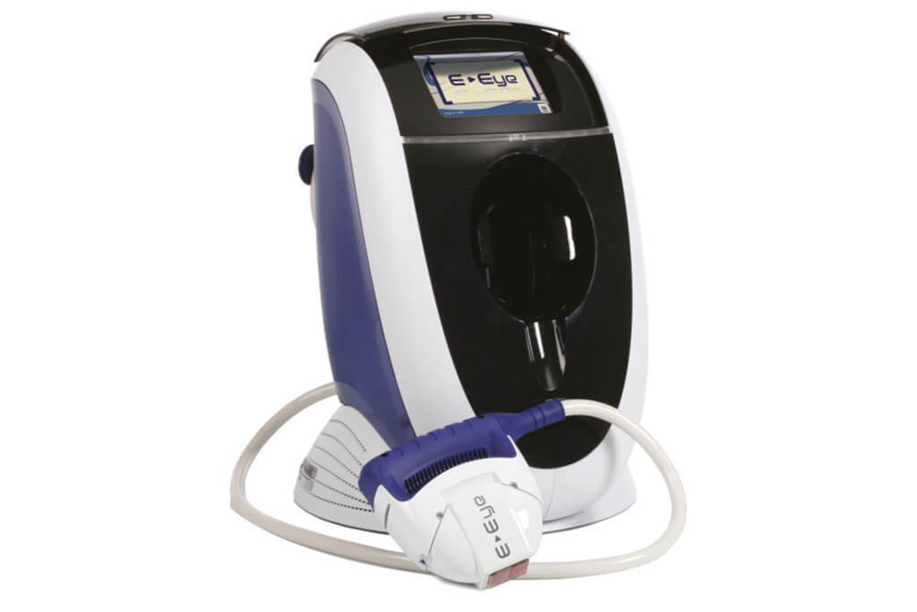 E-Eye Behandlung