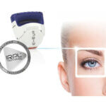 Weltweite Innovation und neues Gerät im Augenlaserzentrum Bányai: E-EYE