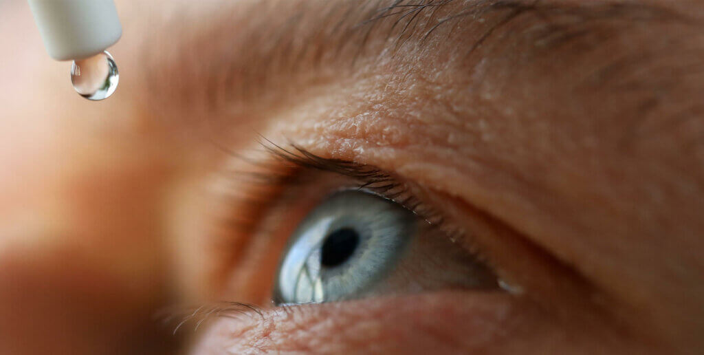 Grauer Star Op: danach sind antibiotische Augentropfen wichtig