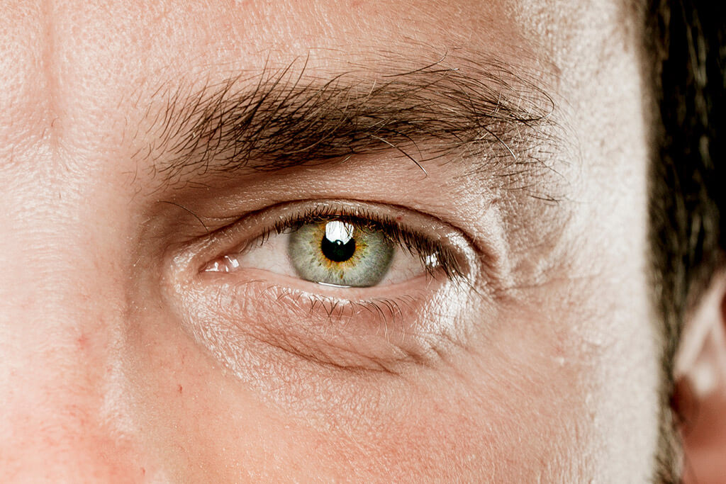 Linsentausch mittels LENSAR Laser